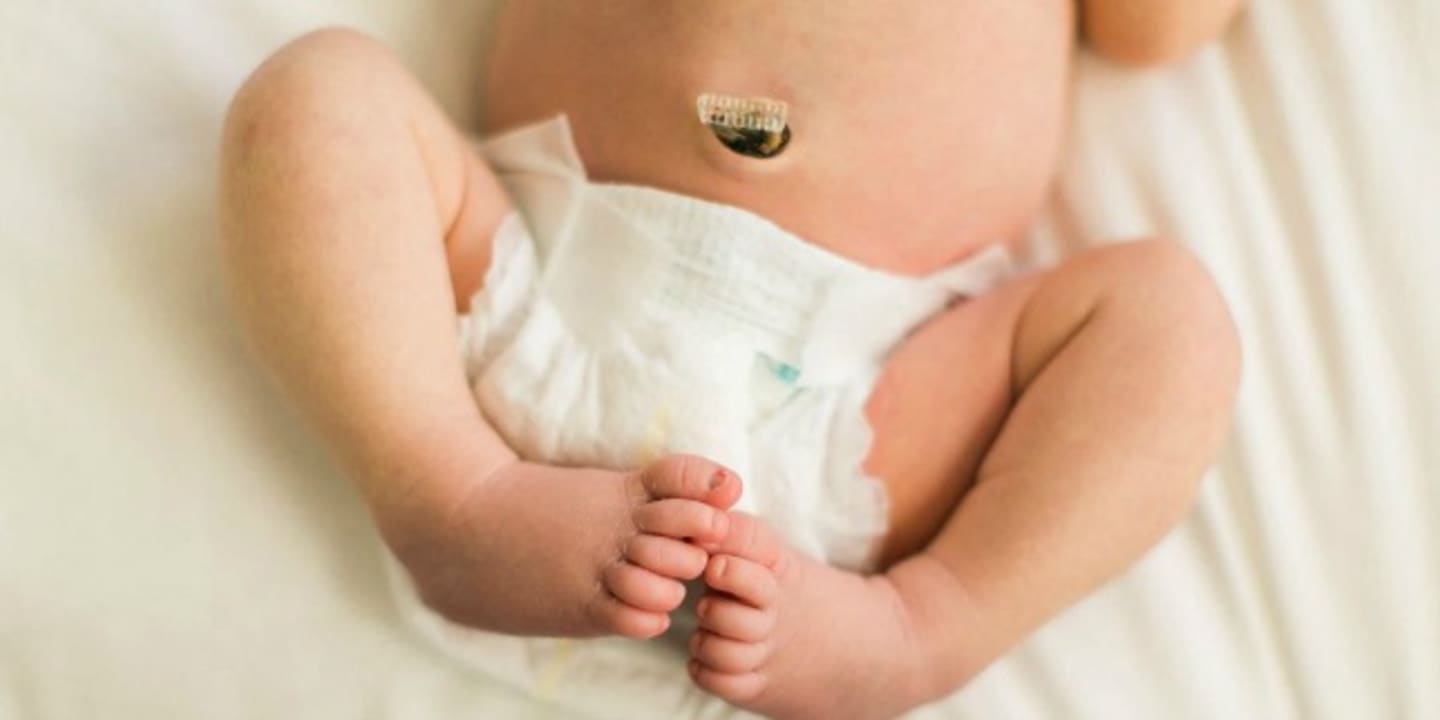 Should I save my baby’s cord blood? baby cord blood