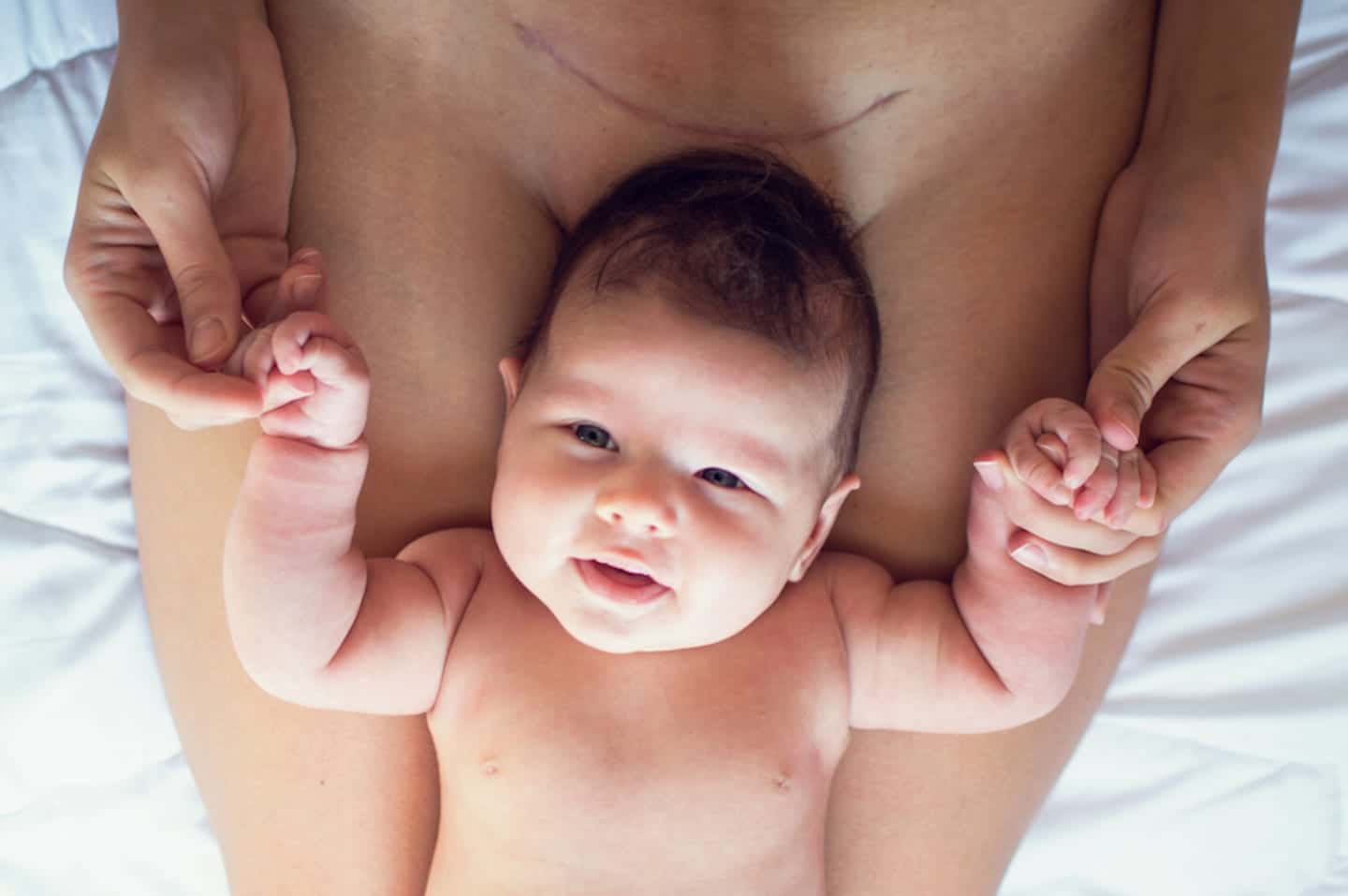 Why ‘belly birth’ is the new way to describe C-sections Cute baby born by belly birth