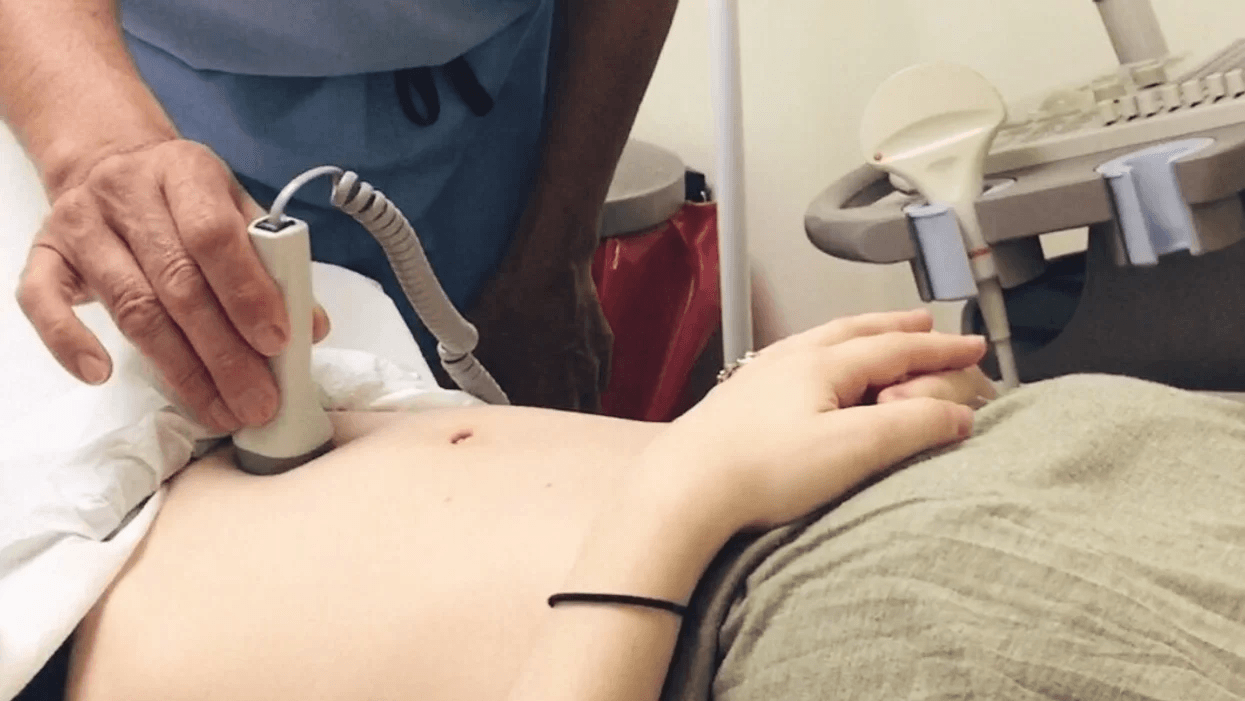 After 3 years of trying and a round of IVF, I am finally pregnant woman getting an ultrasound