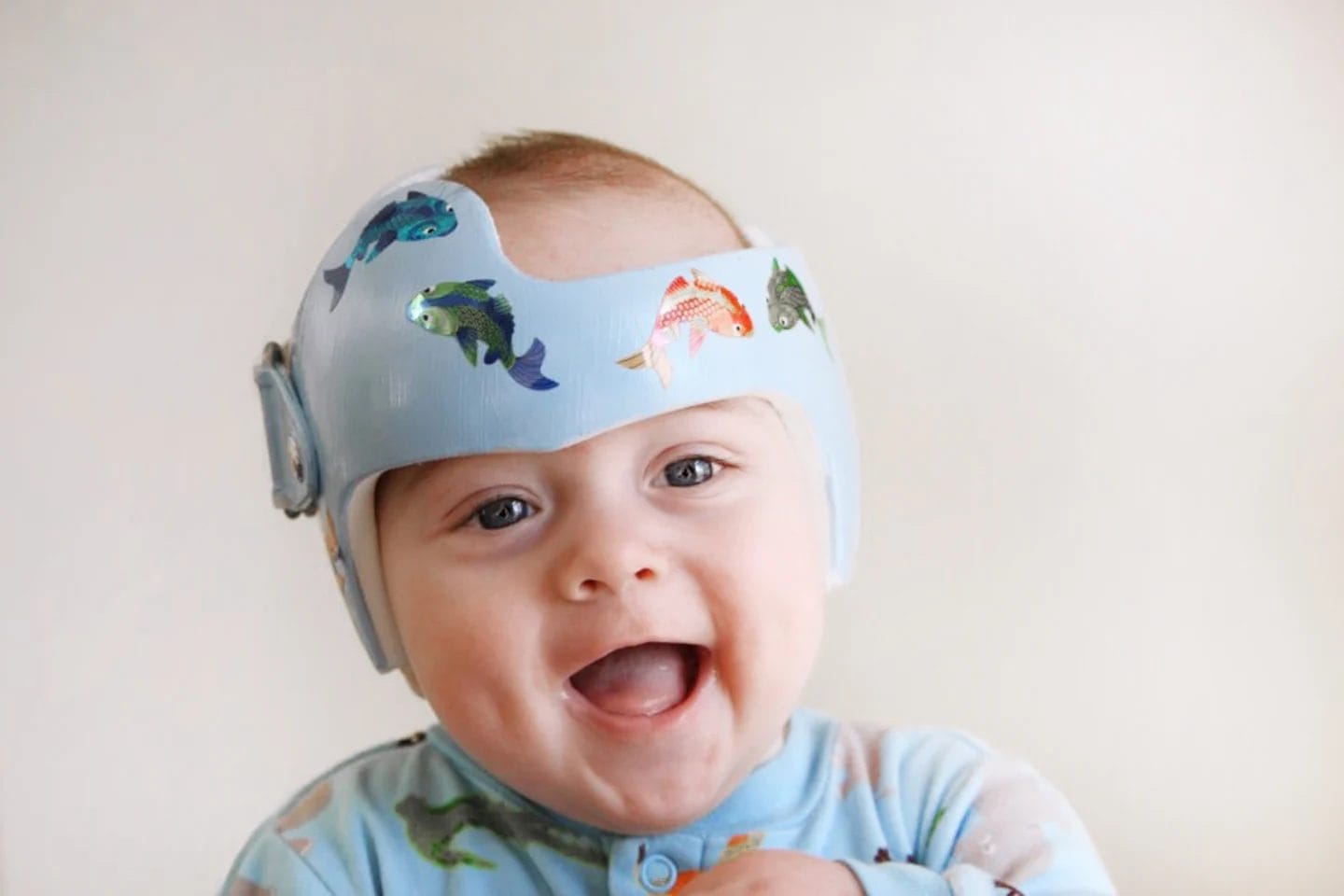Everything you need to know about your baby’s plagiocephaly helmet everything-you-need-to-know-about-your-babys-plagiocephaly-helmet-featured