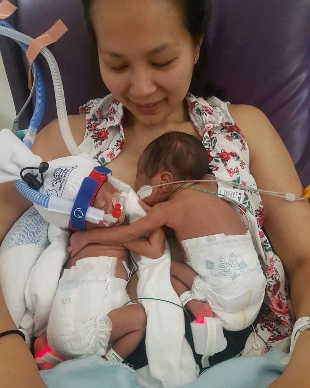 Twin babies separated at birth hug after 27 days apart
