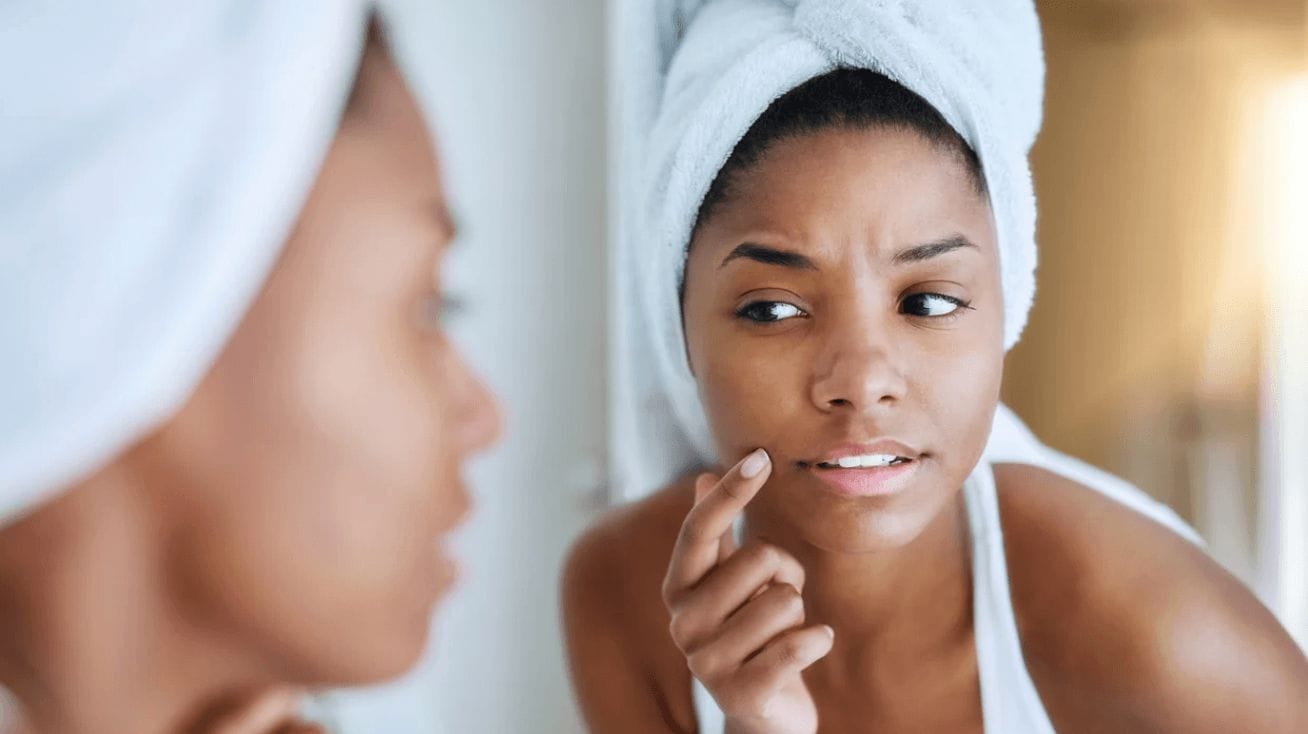 8 common skin issues during pregnancy (and our favorite products to help) woman checking out skin in a mirror