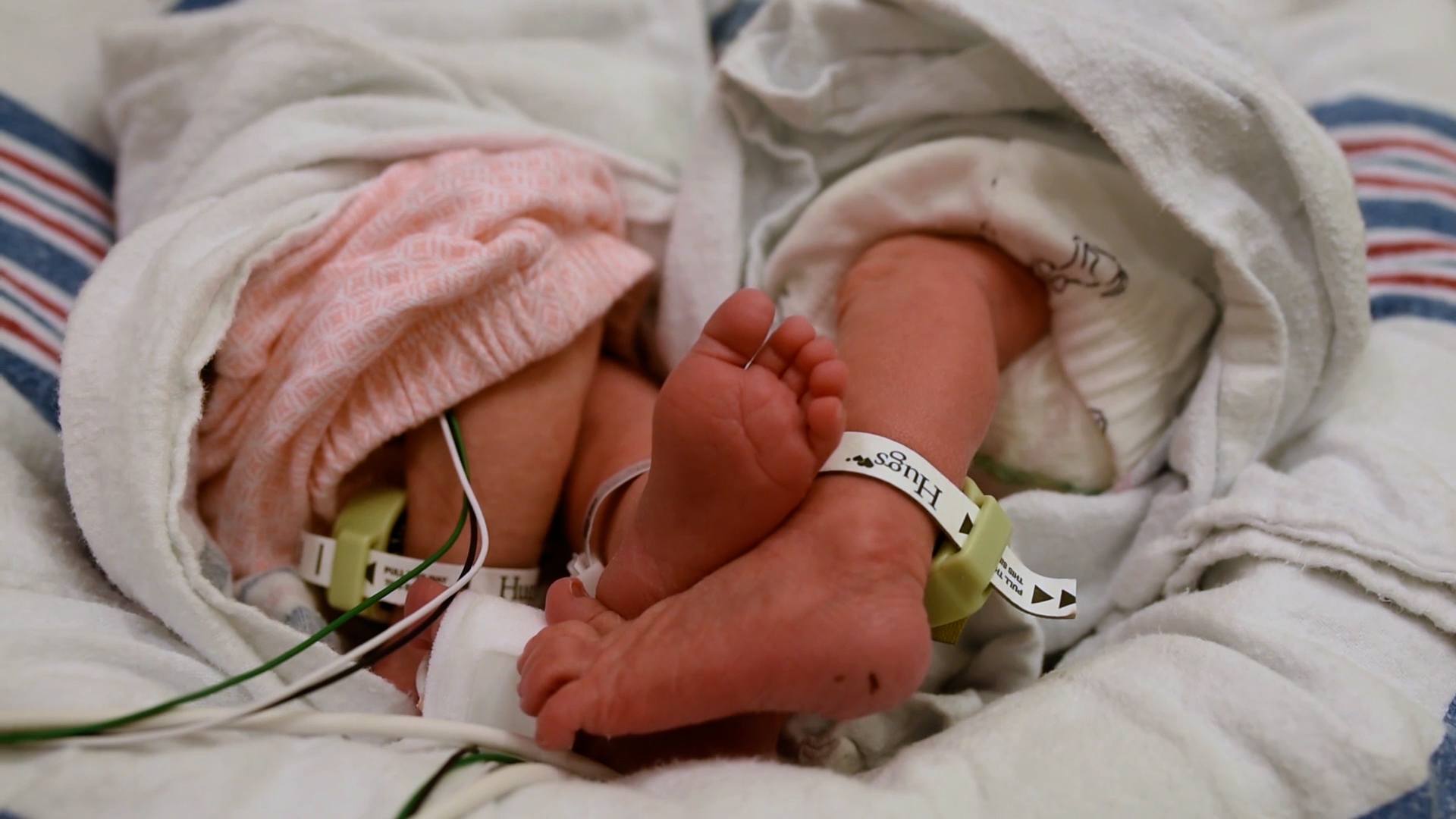 This is birth: A NICU twins’ journey
