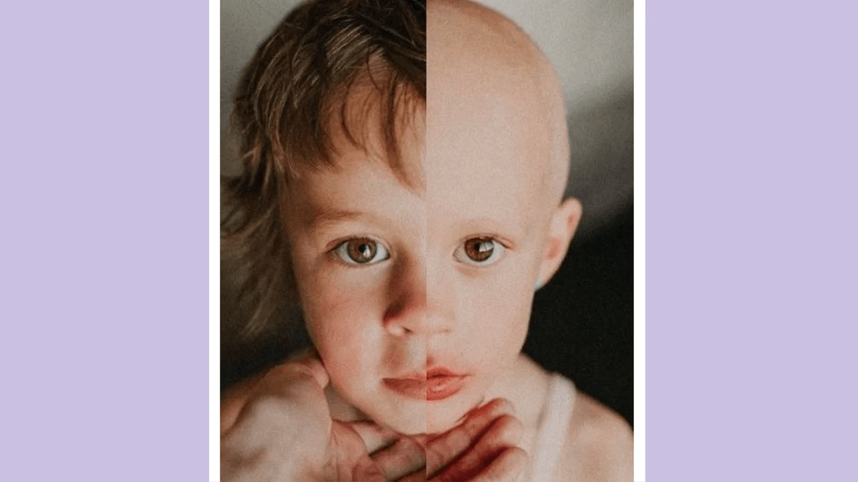 This mom captured her daughter’s cancer journey in powerful photos side by side of a child going through cancer