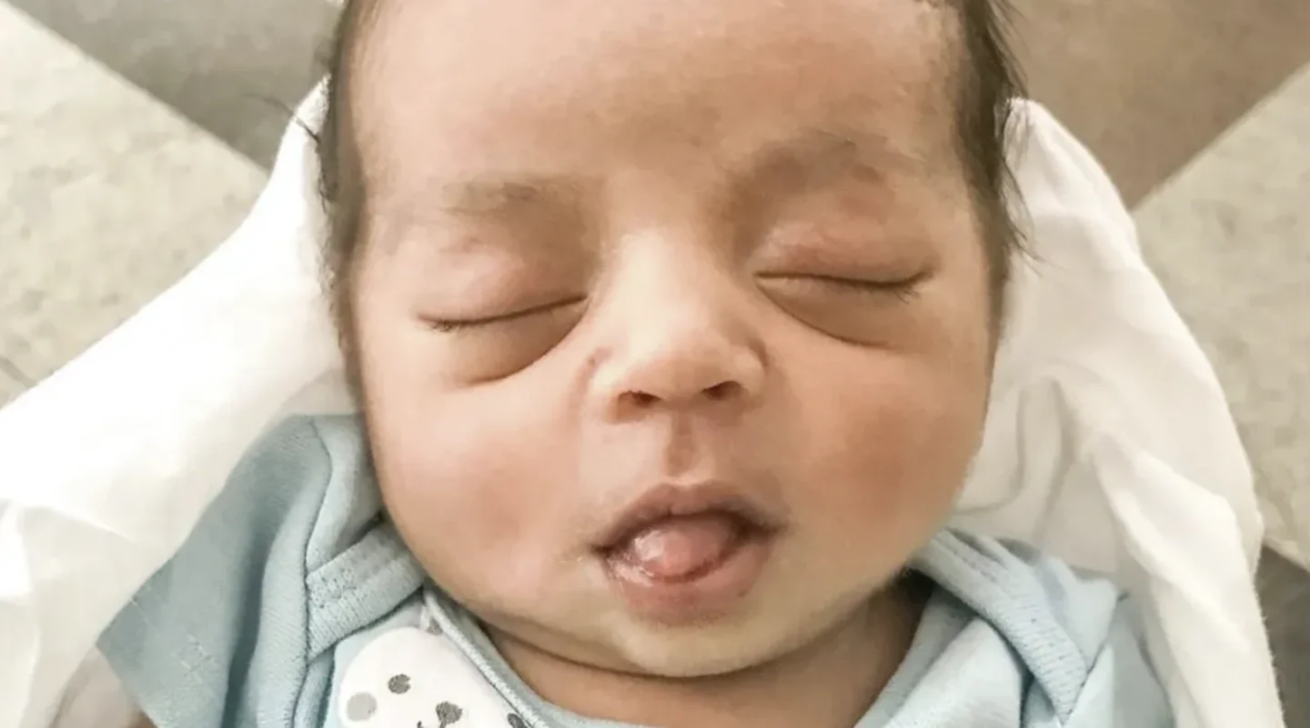 These viral birth photos are helping parents picture life in the womb en caul birth photos