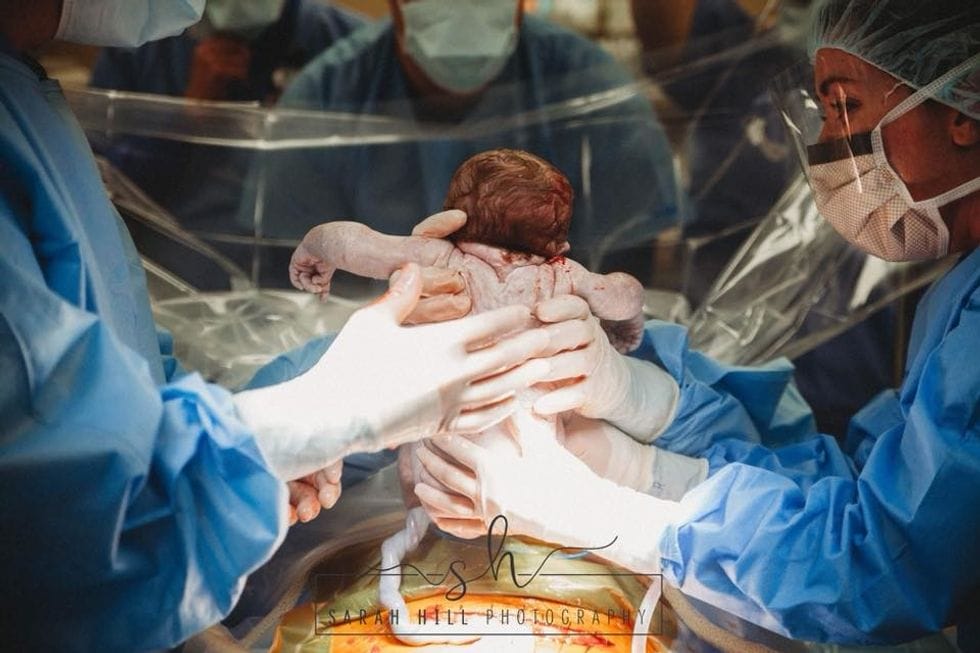 mom delivers her own baby by c section baby coming out