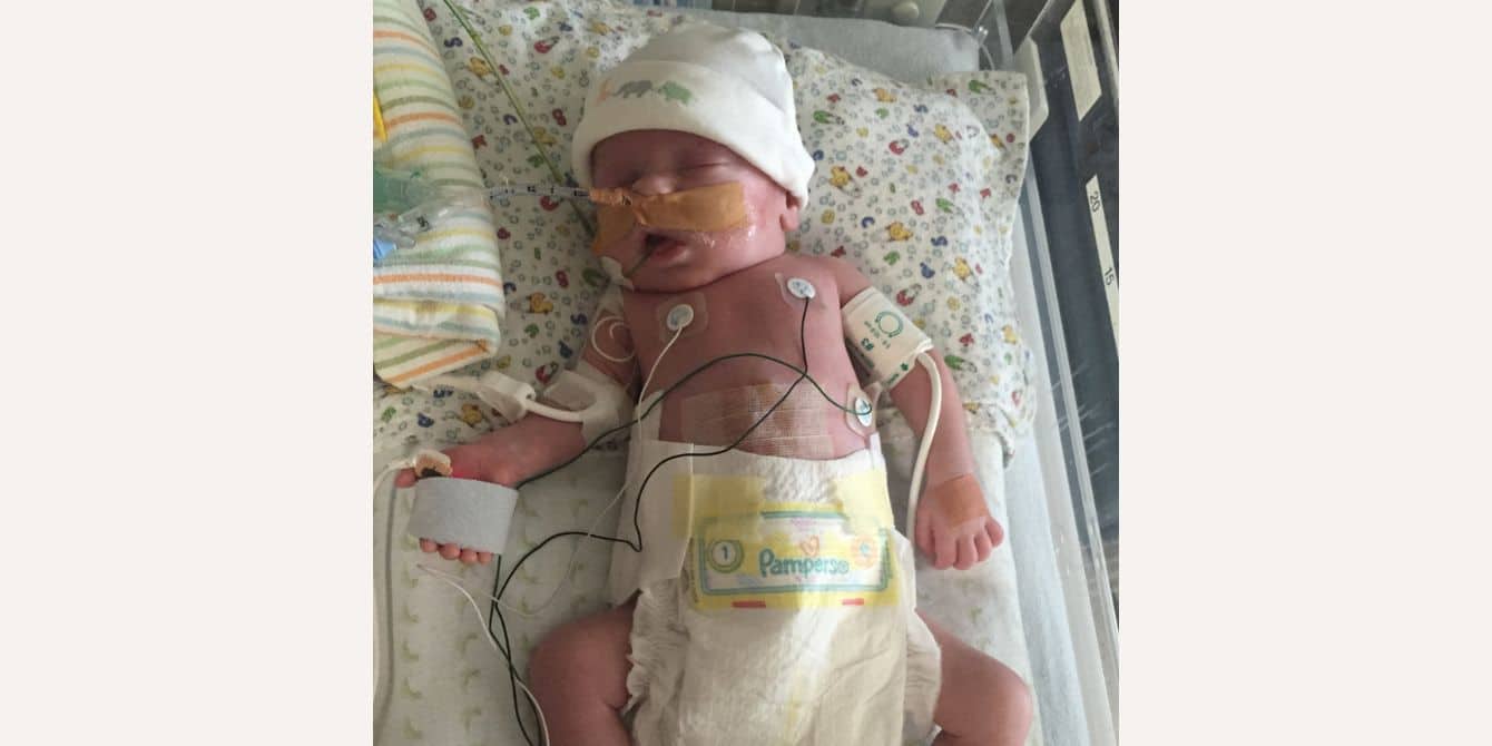 Jessica on having postpartum PTSD being the mom of two sick babies little baby hooked up to machines in the NICU - essay on postpartum PTSD