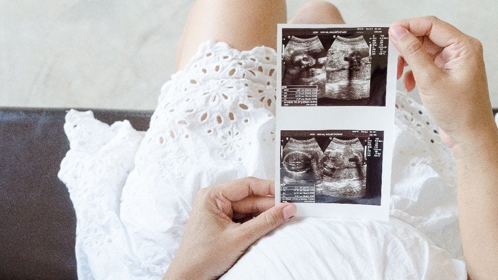 It’s science: 5 ways to awaken baby’s senses in the womb woman holding ultrasound pictures