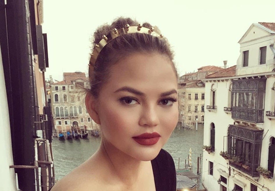 Chrissy Teigen asks for advice on pregnancy headaches—and internet moms deliver