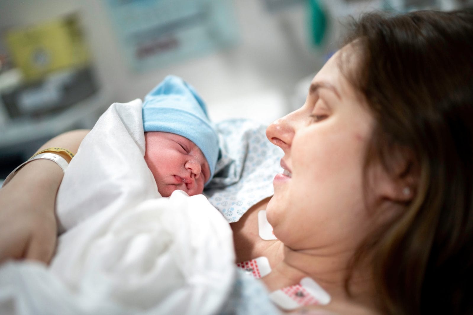 Giving birth under general anesthesia increases your odds of getting PPD by 54%