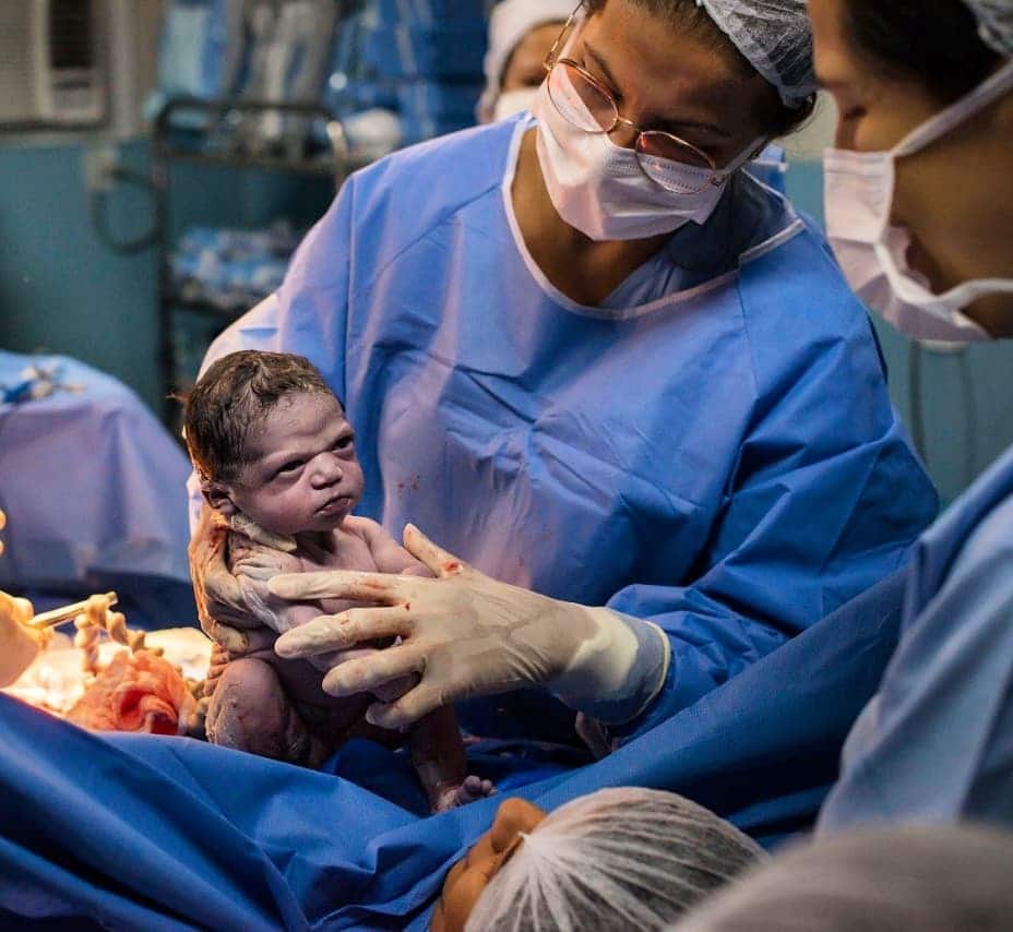 This baby’s viral birth photo is a #mood baby mad face after being delivered