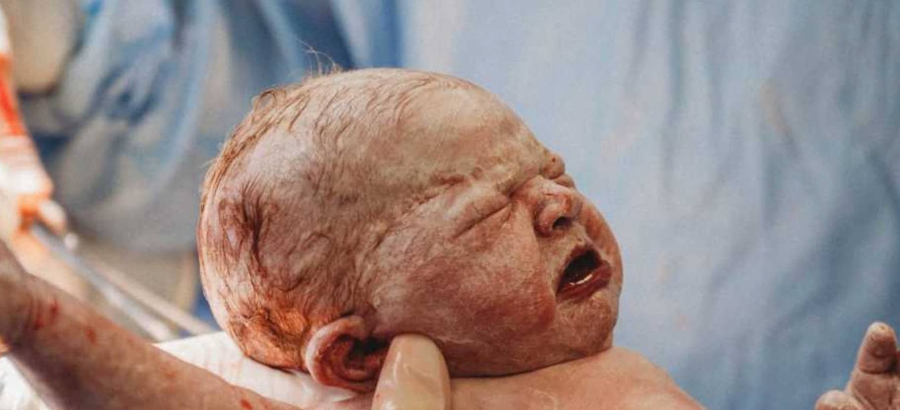 Mom delivers her own baby by C-section—and the pictures are simply amazing mom delivers her own baby by c section newborn