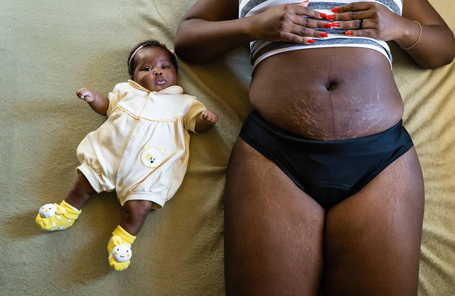 These unfiltered + powerful postpartum photos will make you feel seen