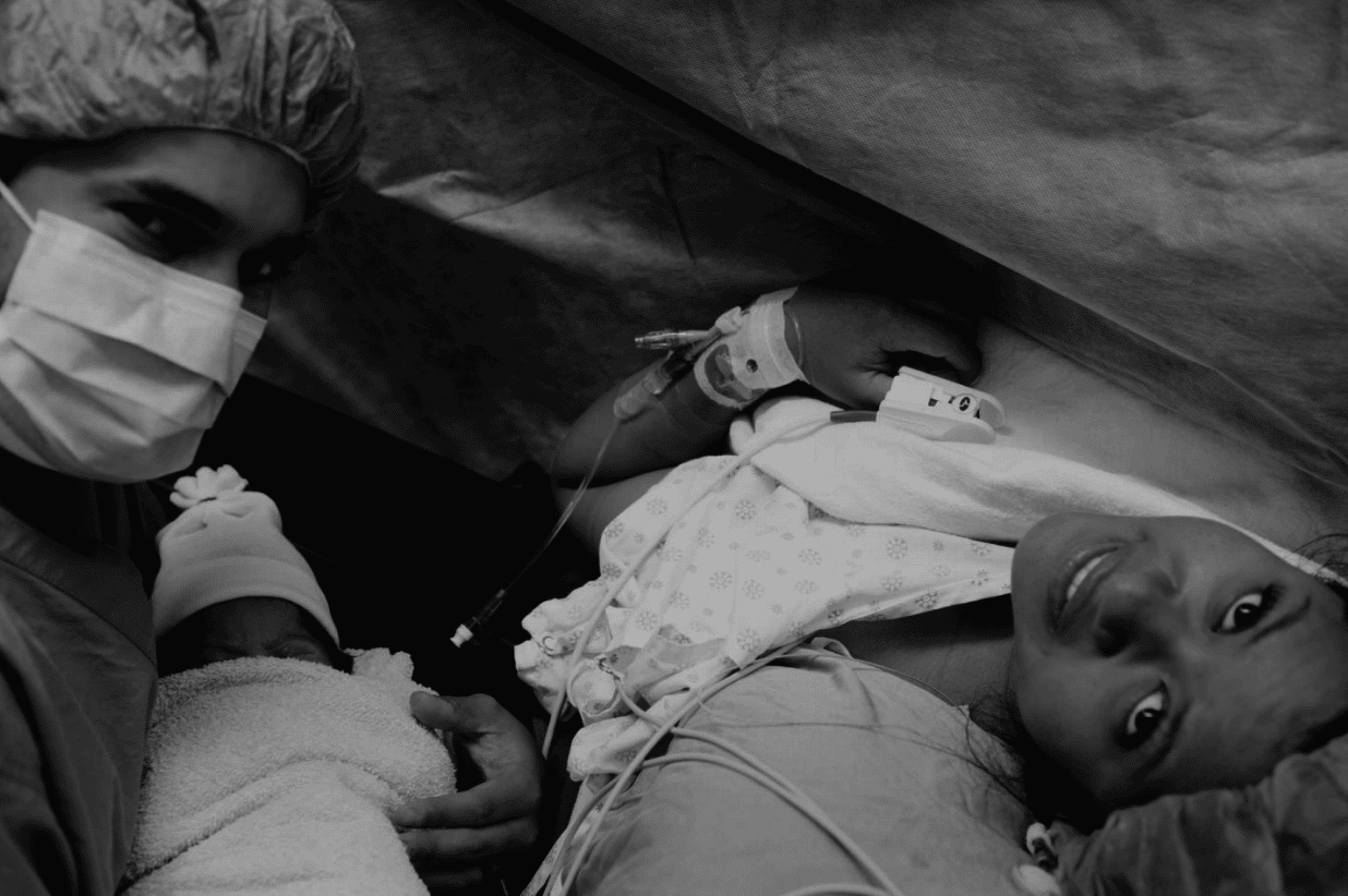 My birth story: An unplanned epidural and C-section epidural birth story photo