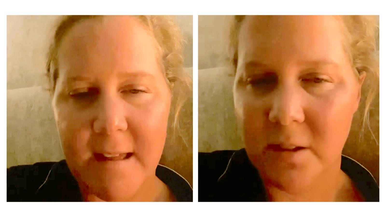 Amy Schumer perfectly nails how society brushes off women’s menstrual pain