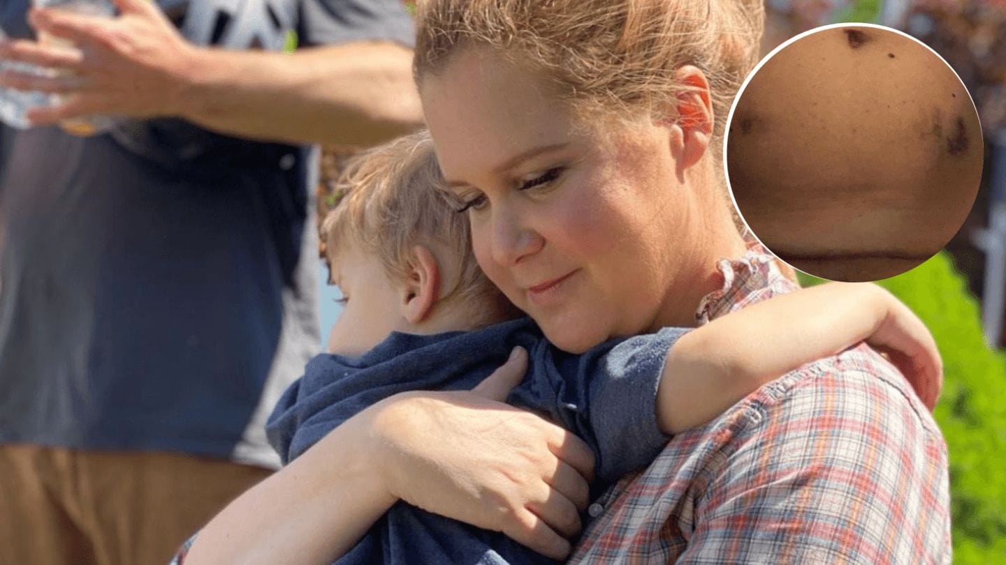 Amy Schumer says IVF made her feel like she was ‘gonna die’ Amy Schumer embraces son Gene