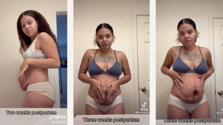 Mom calls out toxic snapback culture by sharing her ‘loose skin and stretch marks’ in viral TikTok tiktok screenshots- snapback culture