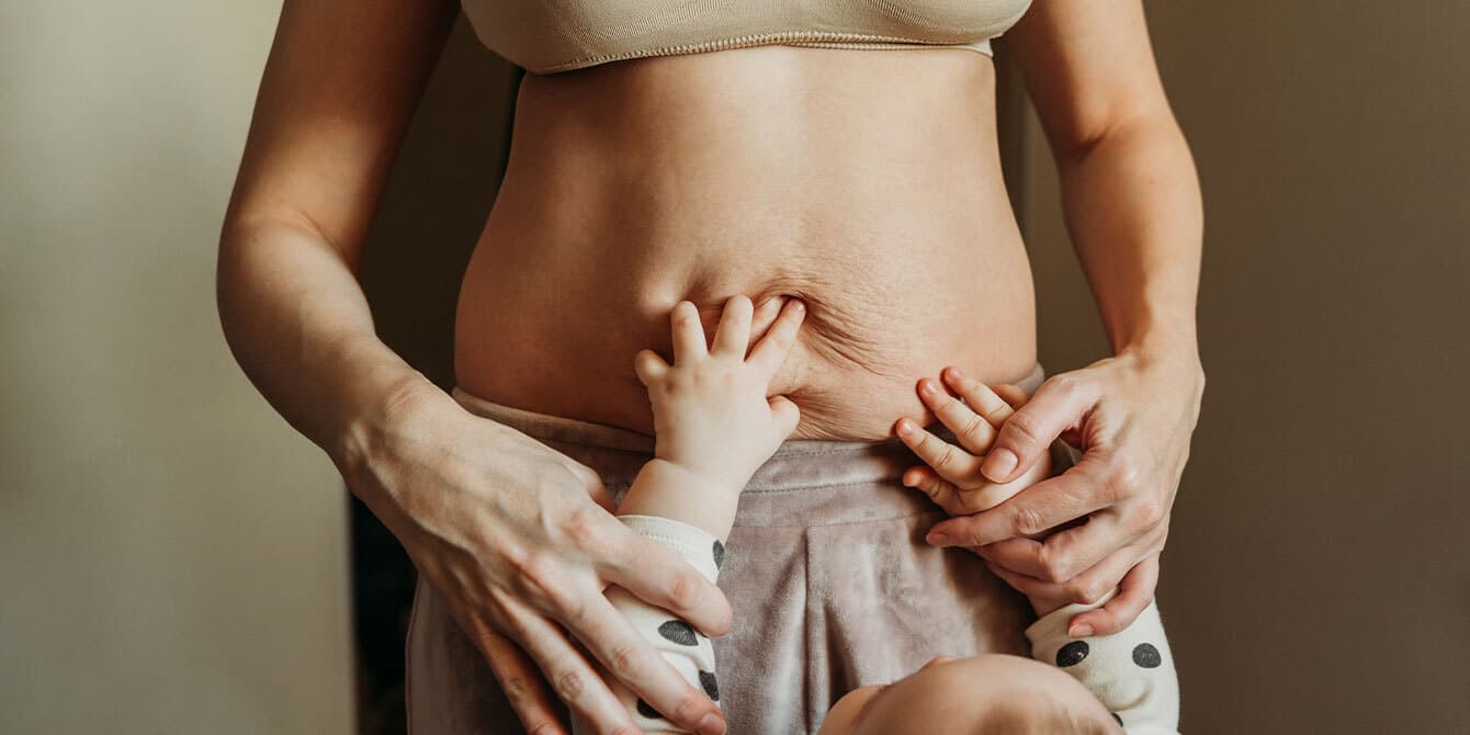 This is the ‘invisibility of motherhood’—and it starts long before actually having kids babys hands on moms belly with stretchmarks - essay on the invisibility of motherhood