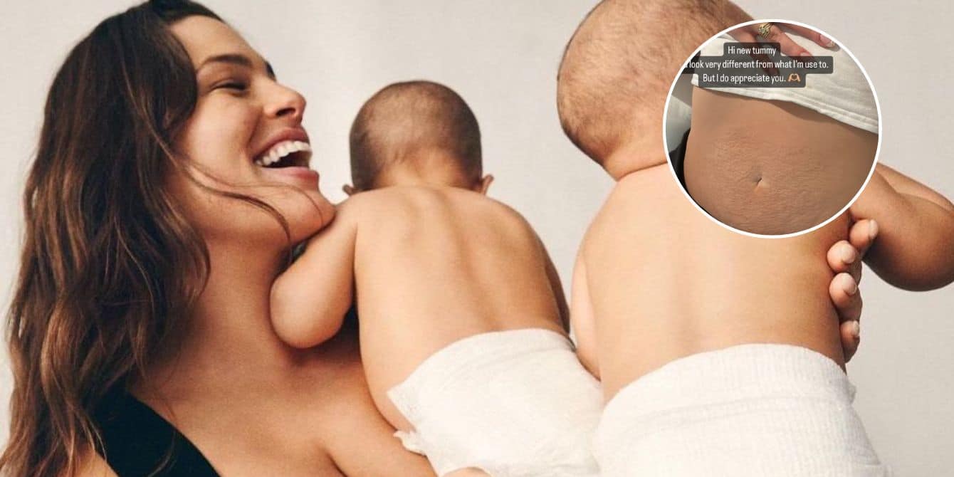 Ashley Graham shares Instagram photo of her ‘very different’ stomach after carrying her twins Ashley Graham poses with her twins and shows her "new" stomach