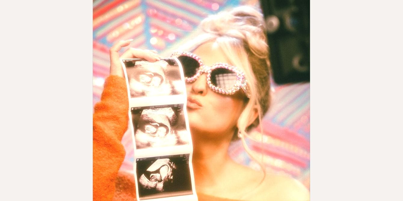 Meghan Trainor announces she’s pregnant with baby #2! Meghan Trainor holding up a sonogram photo