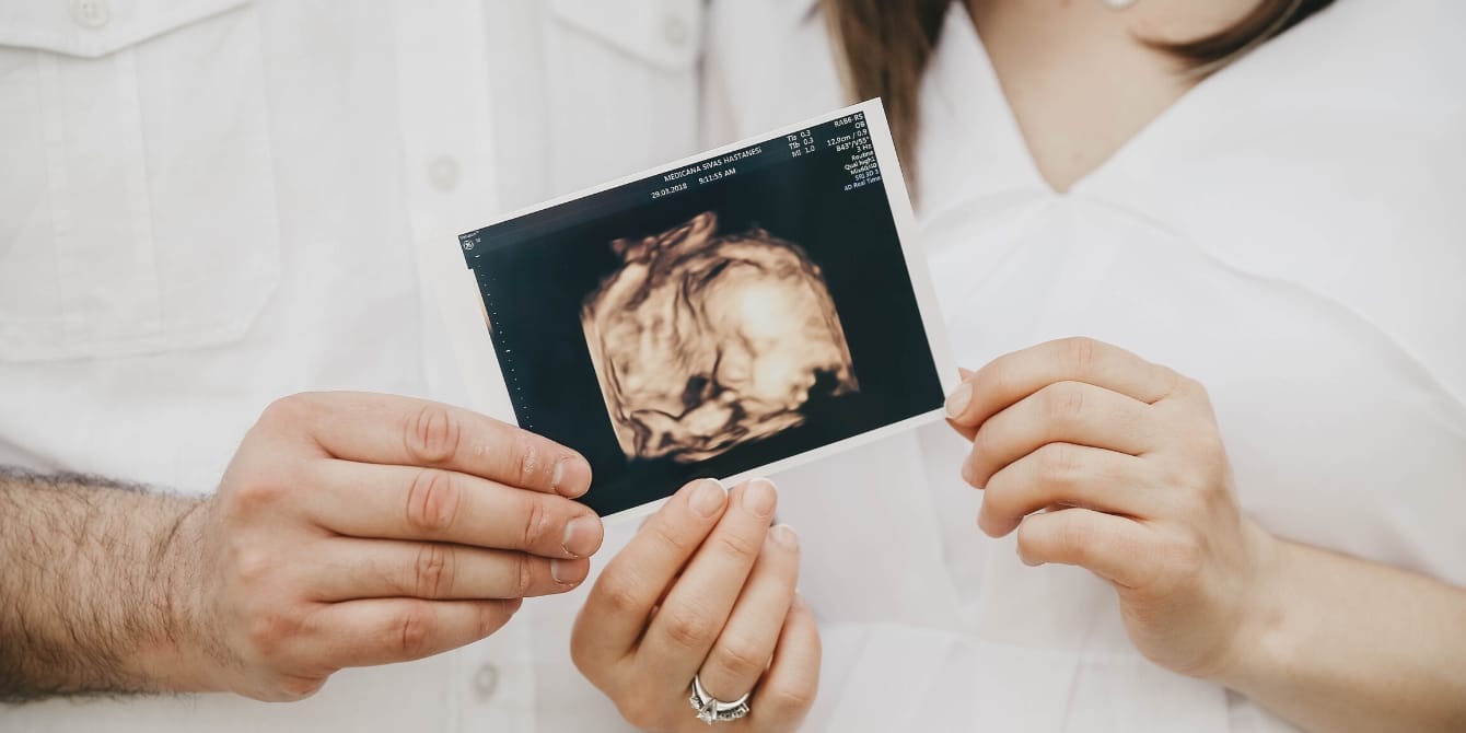 Why I didn’t wait to announce my pregnancy after a loss didnt wait announce pregnancy - pregnancy announcement after loss