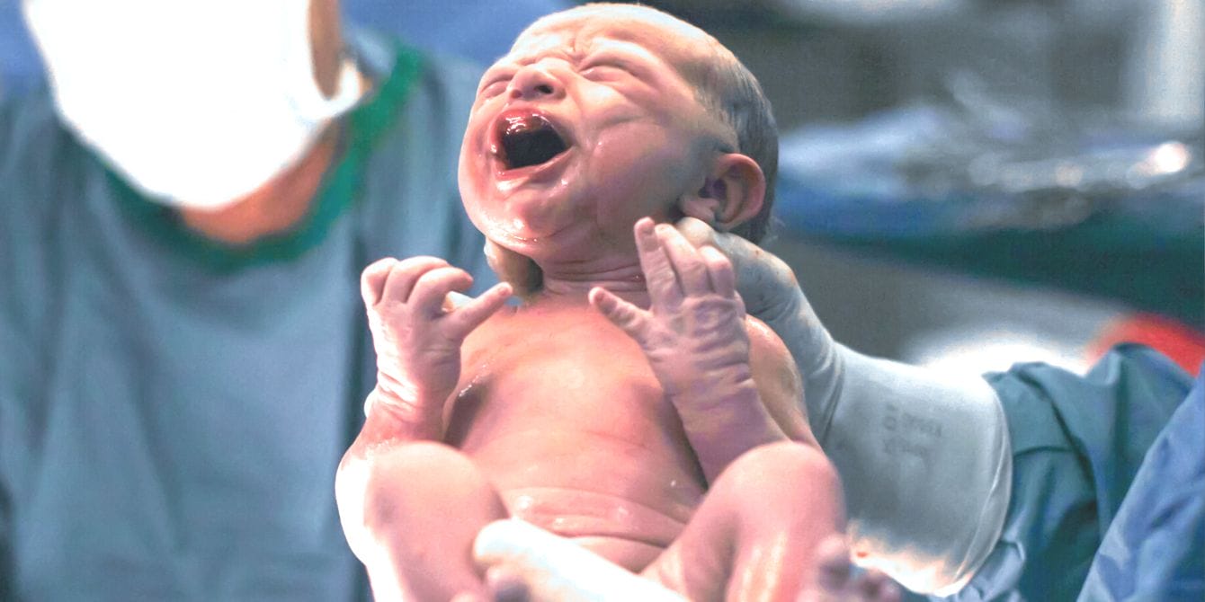 Idaho hospital stops delivering babies because of the state’s near-total abortion ban Newborn baby being delivered