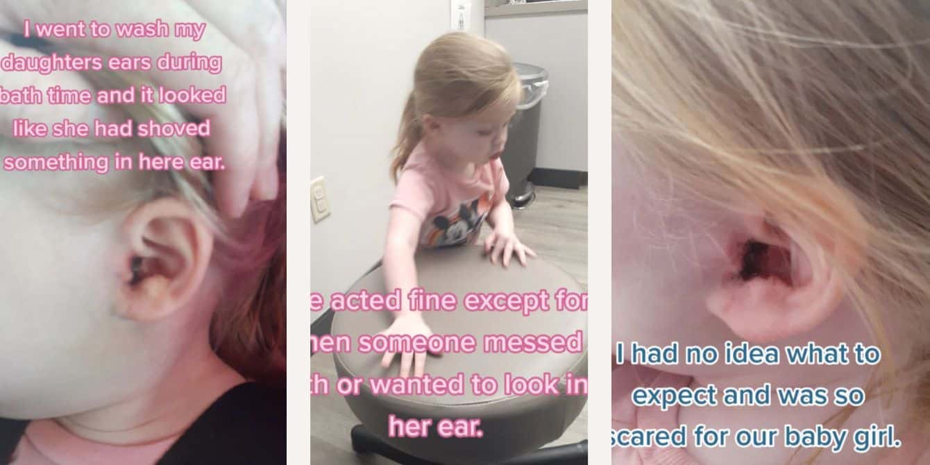 Mom goes viral for sharing absolutely nightmarish seasonal tick reminder Little girl has tick stuck in her ear