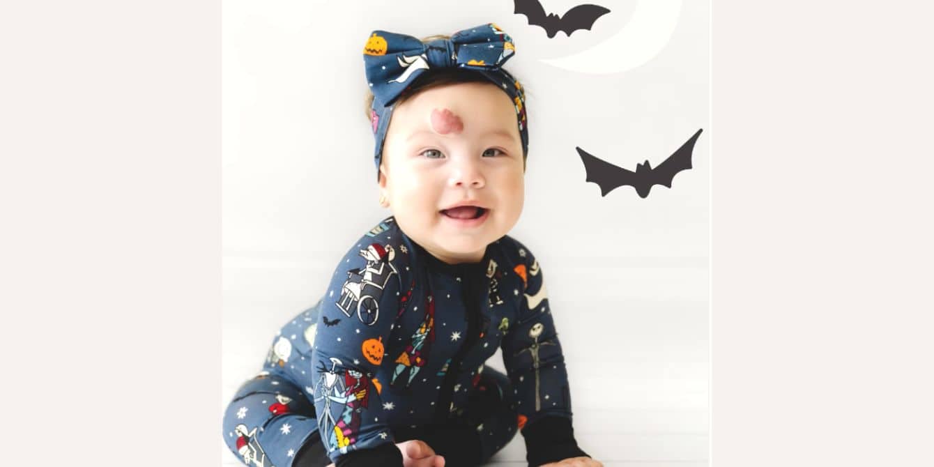 Little Sleepies features baby with hemangioma in ads—and parents everywhere are here for it Little Sleepies baby model