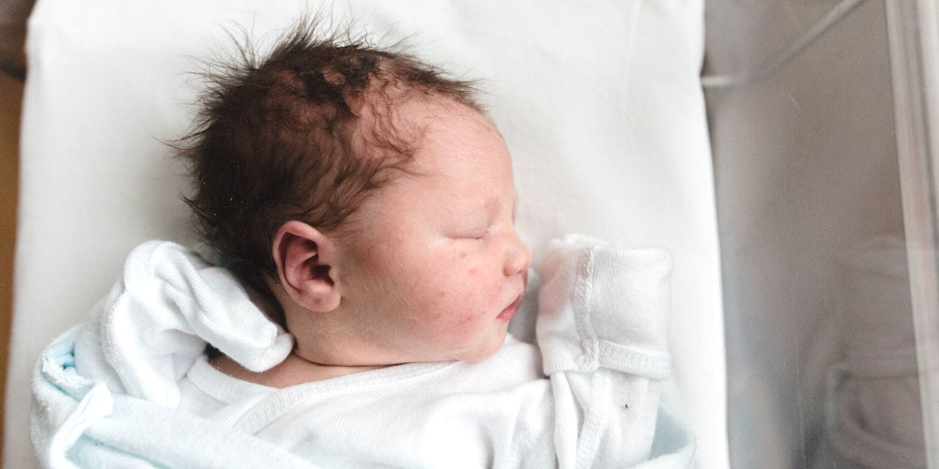 The number of babies born with syphilis is on the rise—but it’s preventable newborn baby in hospital