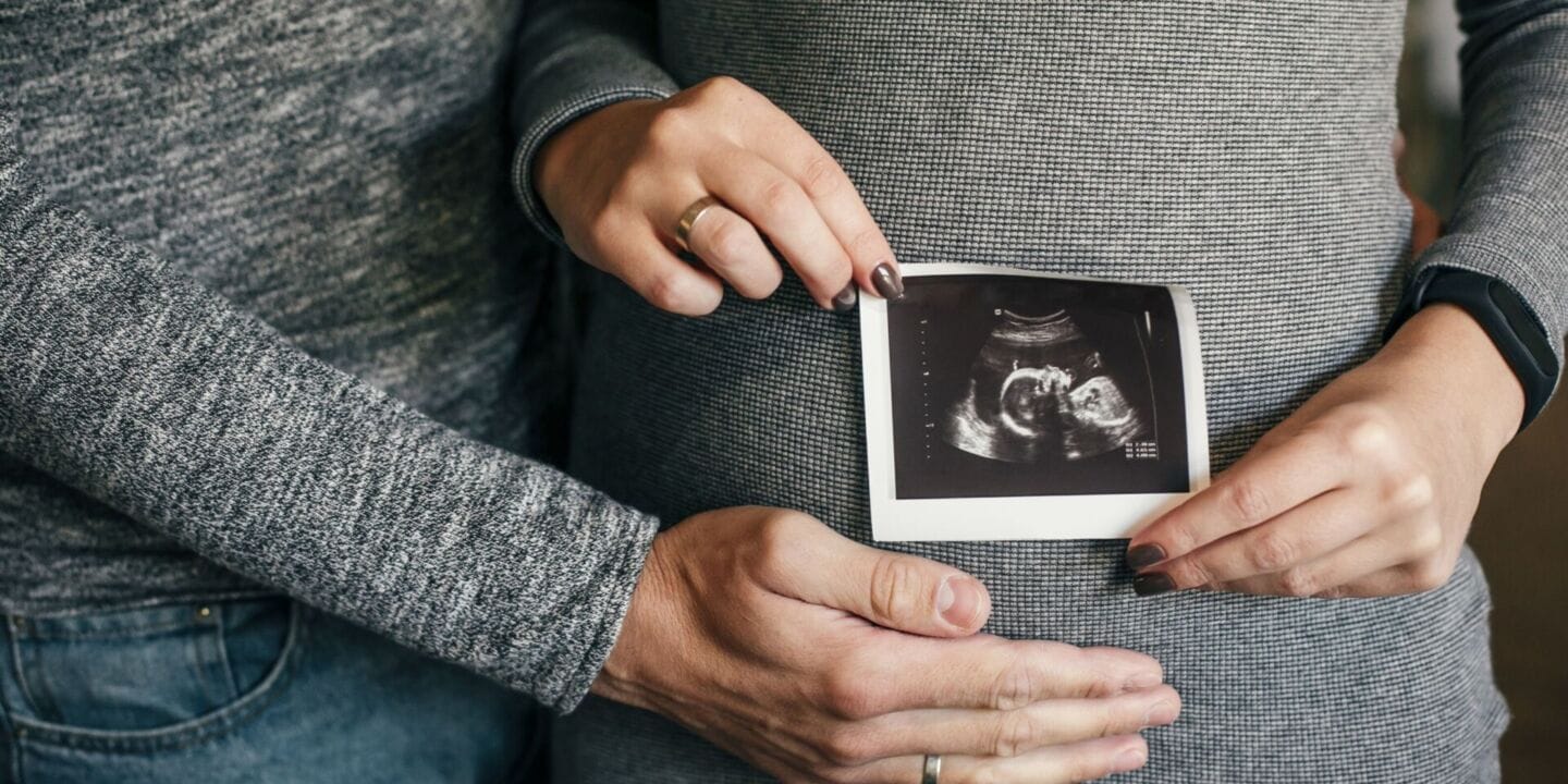 Your preconception health is just as important as your prenatal health a pregnant woman holding an ultrasound picture on her stomach - preconception health