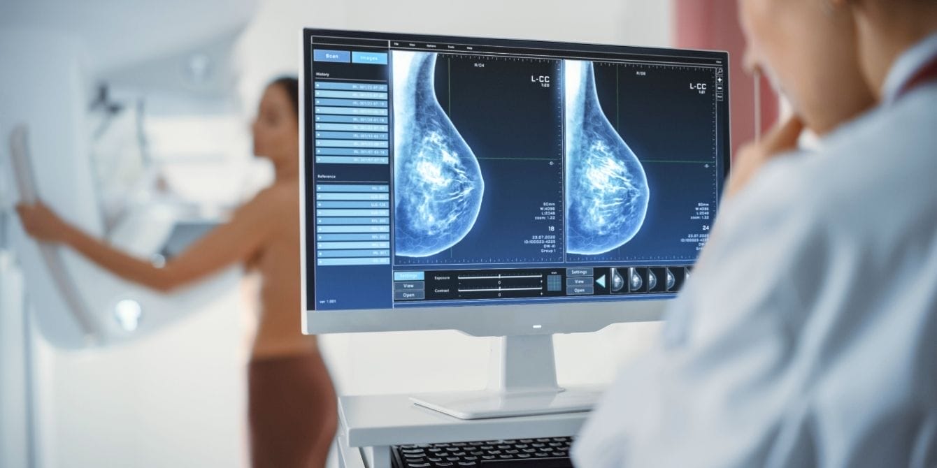 New FDA rule will require mammograms to include assessments on breast density Woman getting mammogram