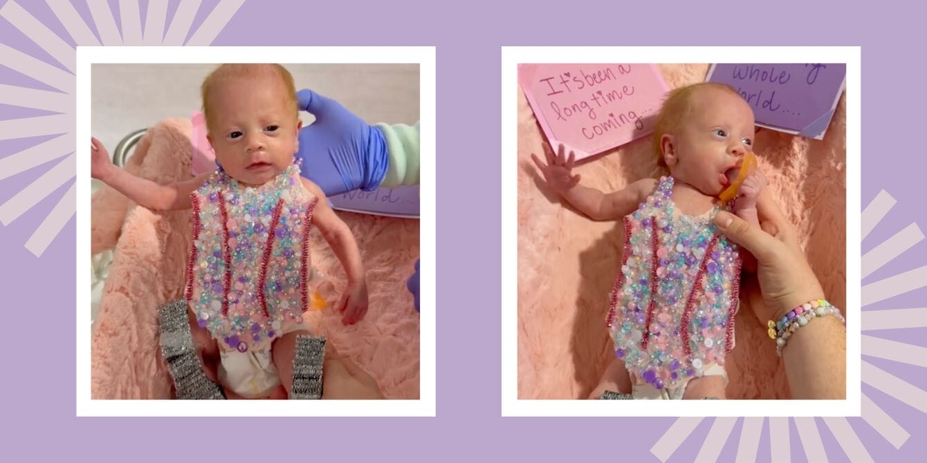 NICU baby’s Taylor Swift costume is melting hearts everywhere taylor swift costume for premature baby