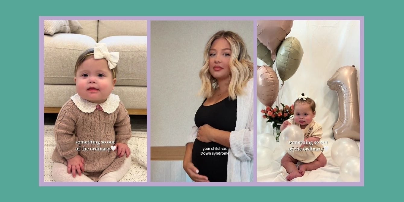 Gen Z mom’s powerful message is changing how the world sees Down syndrome Down syndrome baby