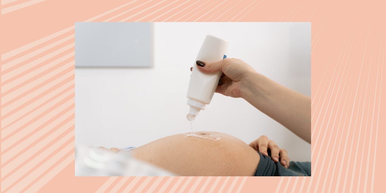 Using IVF - Motherly