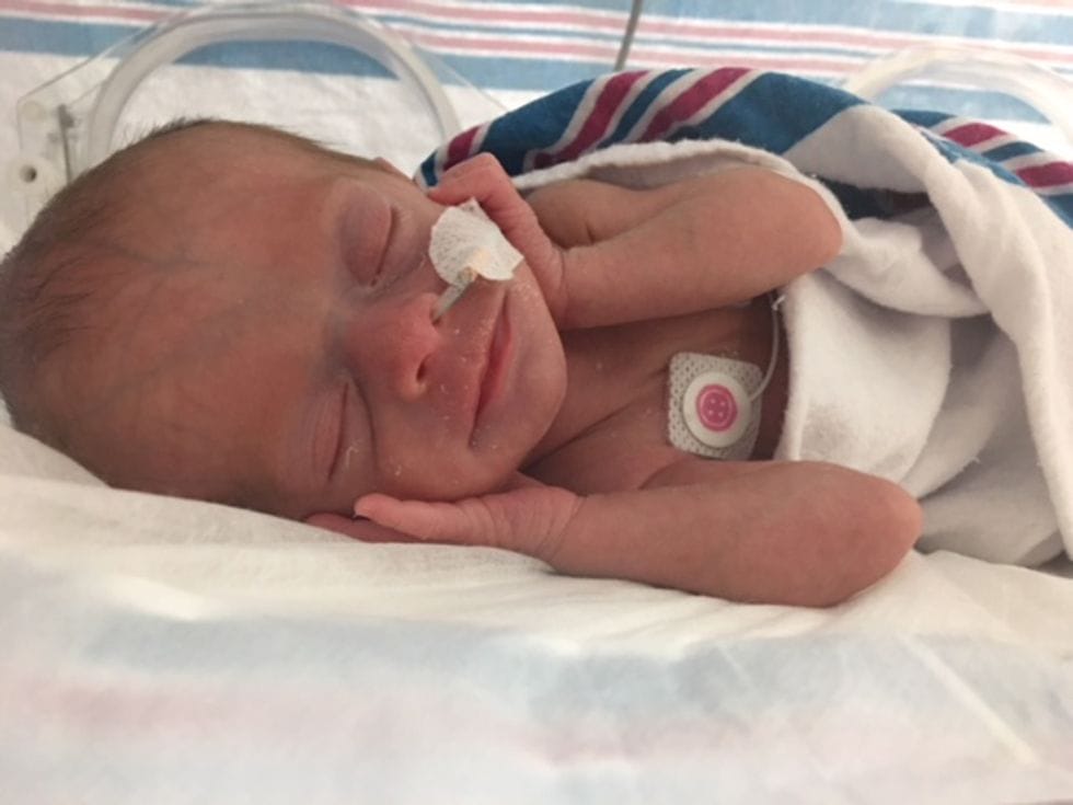giving birth with preeclampsia 0 - Motherly