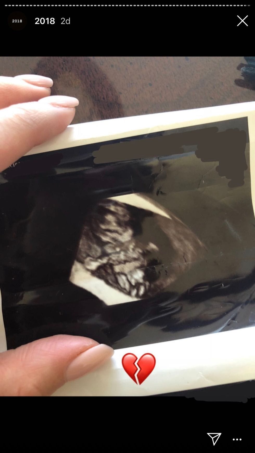 pretty little liars shay mitchell miscarriage 0 - Motherly